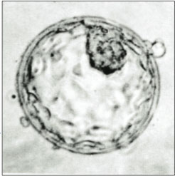 Embrión en fase de blastocisto (6 días), listo para implantarse en el útero