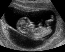Feto en la semana 12